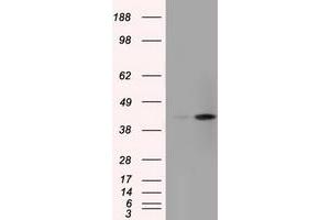 Image no. 6 for anti-Acetyl-CoA Acetyltransferase 2 (ACAT2) antibody (ABIN1496403) (ACAT2 Antikörper)