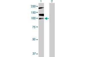 Western Blot analysis of RNF111 expression in transfected 293T cell line by RNF111 MaxPab polyclonal antibody. (RNF111 Antikörper  (AA 1-985))