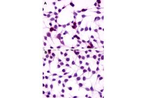 Immunocytochemistry (ICC) staining of HEK293 human embryonic kidney cells transfected (A) or untransfected (B) with GPRC5A. (GPRC5A Antikörper  (Extracellular Domain))