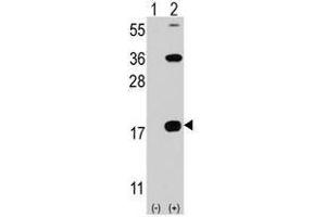 Image no. 1 for anti-CD247 Molecule (CD247) (C-Term) antibody (ABIN356886) (CD247 Antikörper  (C-Term))