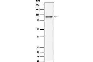 Western blot analysis of ACAP2 expression in 293 cell lysate. (Rekombinanter Centaurin beta 2 Antikörper)