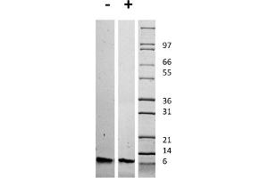 SDS-PAGE (SDS) image for Insulin-Like Growth Factor 1 (IGF1) protein (ABIN6699960)