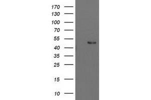 Western Blotting (WB) image for anti-Pre-B-Cell Leukemia Homeobox Protein 1 (PBX1) antibody (ABIN1500044) (PBX1 Antikörper)