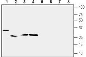 Western blot analysis of mouse heart (lanes 1 and 5), rat skeletal muscle (lanes 2 and 6), rat adipose tissue (lanes 3 and 7) and rat pancreas (lanes 4 and 8):1-4. (Uncoupling Protein 2 (Mitochondrial, Proton Carrier) (UCP2) Peptid)