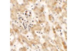 Immunohistochemistry of NKX2-8 in human liver tissue with NKX2-8 antibody at 2. (NKX2-8 Antikörper  (Middle Region))