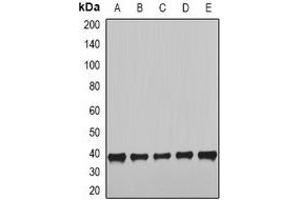 Western blot analysis of NUDE expression in HepG2 (A), SKOV3 (B), MCF7 (C), mouse heart (D), mouse lung (E) whole cell lysates. (NudE Neurodevelopment Protein 1 (NDE1) Antikörper)
