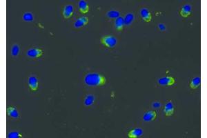 Immunocytochemistry staining of normal human sperma with anti-PRKAR2A antibody (intracellular signal in acrosomes, green), DNA visualized by DAPI (blue). (PRKAR2A Antikörper)