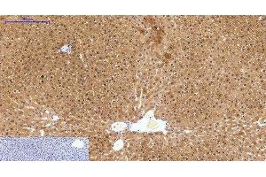 Immunohistochemistry of paraffin-embedded Human liver tissue using HAO1 Monoclonal Antibody at dilution of 1:200. (HAO1 Antikörper)