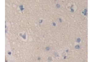 Immunohistochemistry (IHC) image for anti-Chromogranin B (Secretogranin 1) (CHGB) (AA 496-669) antibody (ABIN7435220)