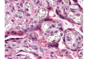 Immunohistochemical analysis of paraffin-embedded human Placenta tissues using CTNNB1 mouse mAb (CTNNB1 Antikörper)