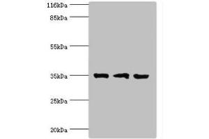 Western blot All lanes: Rab effector Noc2 antibody at 2 μg/mL Lane 1: Rat liver tissue Lane 2: K562 whole cell lysate Lane 3: A549 whole cell lysate Secondary Goat polyclonal to rabbit IgG at 1/10000 dilution Predicted band size: 35, 32 kDa Observed band size: 35 kDa