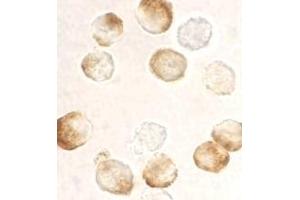 Immunocytochemistry staining of HeLa cells using AP30406PU-N IKK beta antibody at 10 μg/ml. (IKBKB Antikörper  (C-Term))