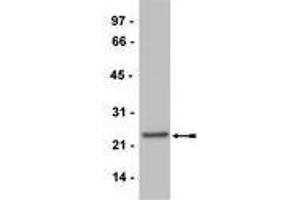 Western Blotting (WB) image for anti-CD3 (CD3) (Activation Site) antibody (ABIN400888) (CD3 Antikörper  (Activation Site))