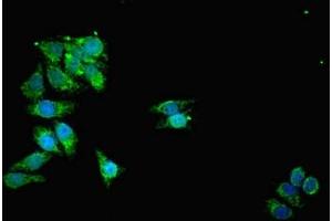Immunofluorescent analysis of HepG2 cells using ABIN7159916 at dilution of 1:100 and Alexa Fluor 488-congugated AffiniPure Goat Anti-Rabbit IgG(H+L) (TOMM2 (AA 20-145) Antikörper)