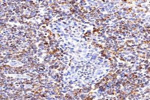 Immunohistochemistry analysis of paraffin-embedded human tonsil using,HLA-DP (ABIN7074613) at dilution of 1: 2400 (HLA-DP Antikörper)