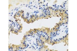 Immunohistochemistry of paraffin-embedded Mouse lung using UVRAG Polyclonal Antibody at dilution of 1:100 (40x lens). (UVRAG Antikörper)