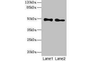 Western blot All lanes: ABHD2 antibody at 10 μg/mL Lane 1: Mouse heart tissue Lane 2: Rat gonadal tissue Secondary Goat polyclonal to rabbit IgG at 1/10000 dilution Predicted band size: 49 kDa Observed band size: 49 kDa (ABHD2 Antikörper  (AA 31-320))