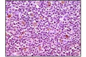 Immunohistochemistry (IHC) image for anti-Induced Myeloid Leukemia Cell Differentiation Protein Mcl-1 (MCL1) antibody (ABIN1108171) (MCL-1 Antikörper)