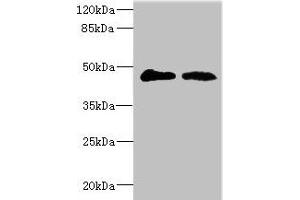 Western blot All lanes: GCNT2 antibody at 3. (GCNT2 Antikörper  (AA 203-402))
