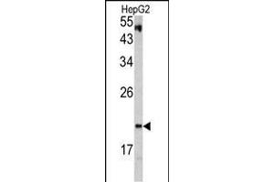 Western Blotting (WB) image for anti-Von Hippel-Lindau Tumor Suppressor, E3 Ubiquitin Protein Ligase (VHL) (AA 181-210), (C-Term) antibody (ABIN390463)