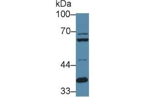 Rabbit Capture antibody from the kit in WB with Positive Control: Sample Human hela cell lysate.
