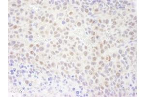 Immunohistochemistry (IHC) image for anti-Replication Protein A1, 70kDa (RPA1) (AA 350-400) antibody (ABIN7448781) (RPA1 Antikörper  (AA 350-400))