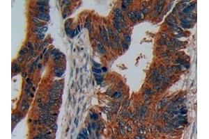 Immunohistochemistry (IHC) image for anti-Disrupted in Schizophrenia 1 (DISC1) (AA 102-261) antibody (ABIN7439720)
