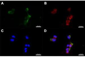 Immunofluorescent staining of human nasal epithelial cells with CD151 polyclonal antibody  at 1:100 dilution. (CD151 Antikörper  (C-Term))