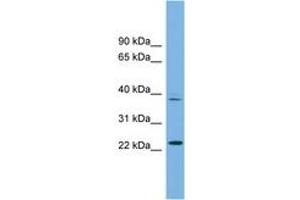 Image no. 1 for anti-Transcription Factor Dp Family, Member 3 (TFDP3) (AA 71-120) antibody (ABIN6745240) (TFDP3 Antikörper  (AA 71-120))