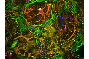 View of mixed neuron/glial cultures stained with vimentin antibody (green) and rabbit antibody to GFAP antibody (red). (Vimentin Antikörper)