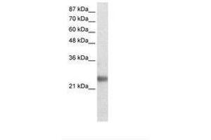 Image no. 1 for anti-Ring Finger Protein 114 (RNF114) (AA 77-126) antibody (ABIN202094) (RNF114 Antikörper  (AA 77-126))