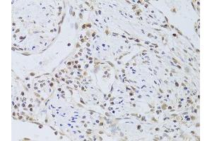 Immunohistochemistry (Paraffin-embedded Sections) (IHC (p)) image for anti-FK506 Binding Protein 4, 59kDa (FKBP4) (AA 220-459) antibody (ABIN6140658)
