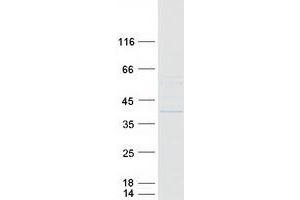 Western Blotting (WB) image for F-Box and Leucine-Rich Repeat Protein 12 (FBXL12) protein (Myc-DYKDDDDK Tag) (ABIN2720930)