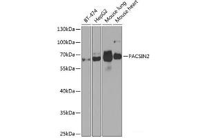 Western blot analysis of extracts of various cell lines using PACSIN2 Polyclonal Antibody at dilution of 1:1000. (PACSIN2 Antikörper)