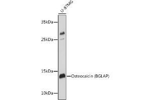 Western blot analysis of extracts of U-87MG cells, using Osteocalcin (BGLAP) antibody (ABIN6134565, ABIN6137546, ABIN6137547 and ABIN6221793) at 1:1000 dilution. (Osteocalcin Antikörper  (AA 1-100))