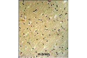 Immunohistochemistry (Paraffin-embedded Sections) (IHC (p)) image for anti-BCL6 Co-Repressor (BCOR) (AA 1107-1137) antibody (ABIN391538)