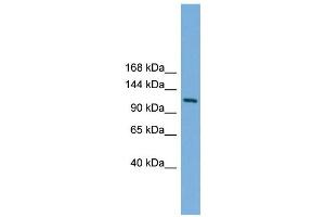 WB Suggested Anti-Myt1 Antibody Titration: 0. (MYT1 Antikörper  (N-Term))