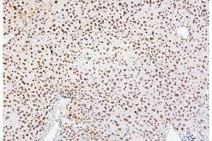 IHC analysis of H1F0 using anti-H1F0 antibody (ABIN7600521). (Histone H1 Antikörper  (AA 20-159))