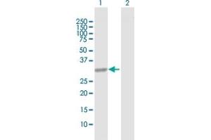 Western Blot analysis of CBR1 expression in transfected 293T cell line by CBR1 MaxPab polyclonal antibody. (CBR1 Antikörper  (AA 1-277))