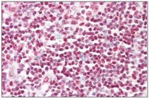 Human Tonsil: Formalin-Fixed, Paraffin-Embedded (FFPE) (HNRNPD/AUF1 Antikörper)