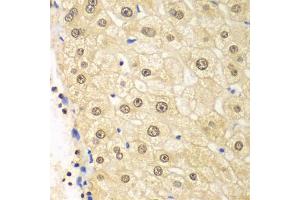 Immunohistochemistry of paraffin-embedded human liver injury using PSMD2 antibody (ABIN5971041) at dilution of 1/100 (40x lens). (PSMD2 Antikörper)
