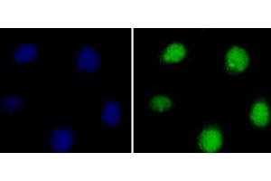 Immunofluorescence analysis of 293T cells using Symmetric DiMethyl-Histone H3-R8 Polyclonal Antibody (Histone 3 Antikörper  (H3R8me2s))