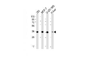All lanes : Anti-PDXK Antibody (N-term) at 1:4000 dilution Lane 1: 293 whole cell lysate Lane 2: MCF-7 whole cell lysate Lane 3: U-251 MG whole cell lysate Lane 4: Human liver lysate Lysates/proteins at 20 μg per lane. (PDXK Antikörper  (AA 1-312))