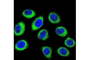Confocal immunofluorescent analysis of GCLC Antibody (N-term) (ABIN655884 and ABIN2845285) with U-251MG cell followed by Alexa Fluor 488-conjugated goat anti-rabbit lgG (green). (GCLC Antikörper  (N-Term))