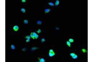 Immunofluorescent analysis of 293T cells using ABIN7170979 at dilution of 1:100 and Alexa Fluor 488-congugated AffiniPure Goat Anti-Rabbit IgG(H+L) (SOD1 Antikörper  (AA 2-154))