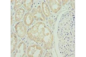 Immunohistochemistry of paraffin-embedded human kidney tissue using ABIN7176706 at dilution of 1:100 (SLC39A4 Antikörper  (AA 23-327))