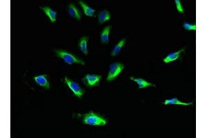 Immunofluorescent analysis of Hela cells using ABIN7170906 at dilution of 1:100 and Alexa Fluor 488-congugated AffiniPure Goat Anti-Rabbit IgG(H+L) (SUCNR1 Antikörper  (AA 303-334))