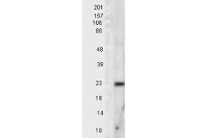 Western Blotting (WB) image for anti-Superoxide Dismutase 2, Mitochondrial (SOD2) antibody (ABIN361656)