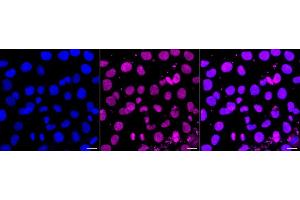Immunocytochemical staining of HT- cells with SENP2 antibody (ABIN7800976), 1:1,000). (Rekombinanter SUMO Specific Peptidase 2 Antikörper)