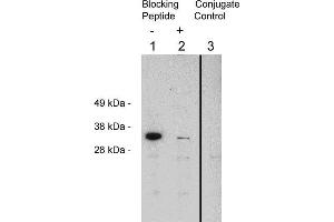 Western blot using  X1874P, rabbit polyclonal at 0. (FHL2 Antikörper)